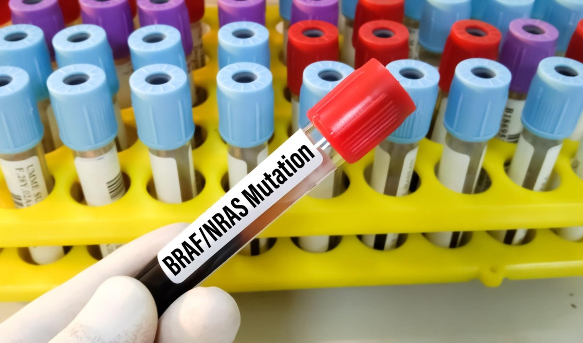 gene đột biến xuất hiện ở u sắc tố giai đoạn muộn