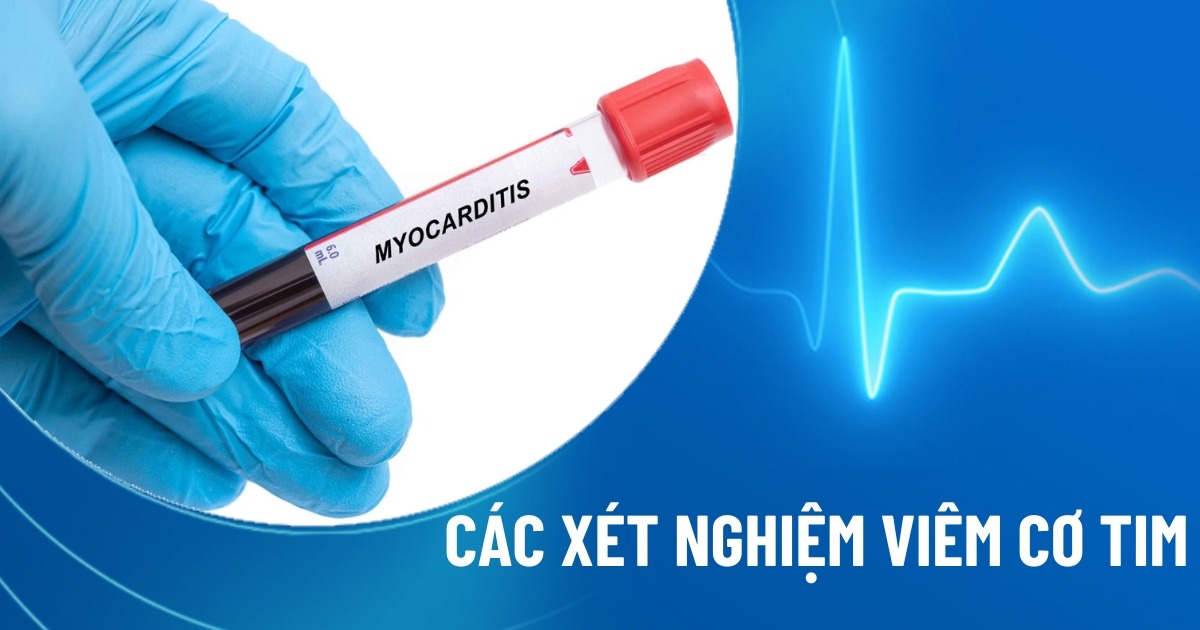 xét nghiệm viêm cơ tim