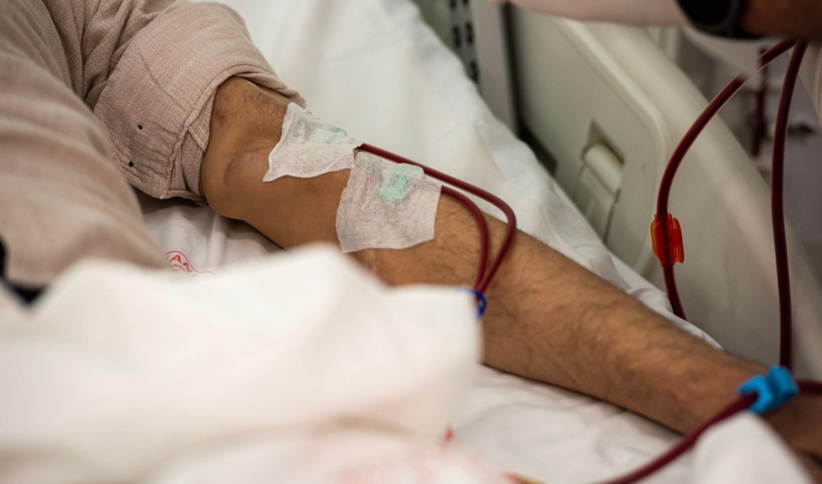 lọc máu trị bệnh cơ tim amyloid