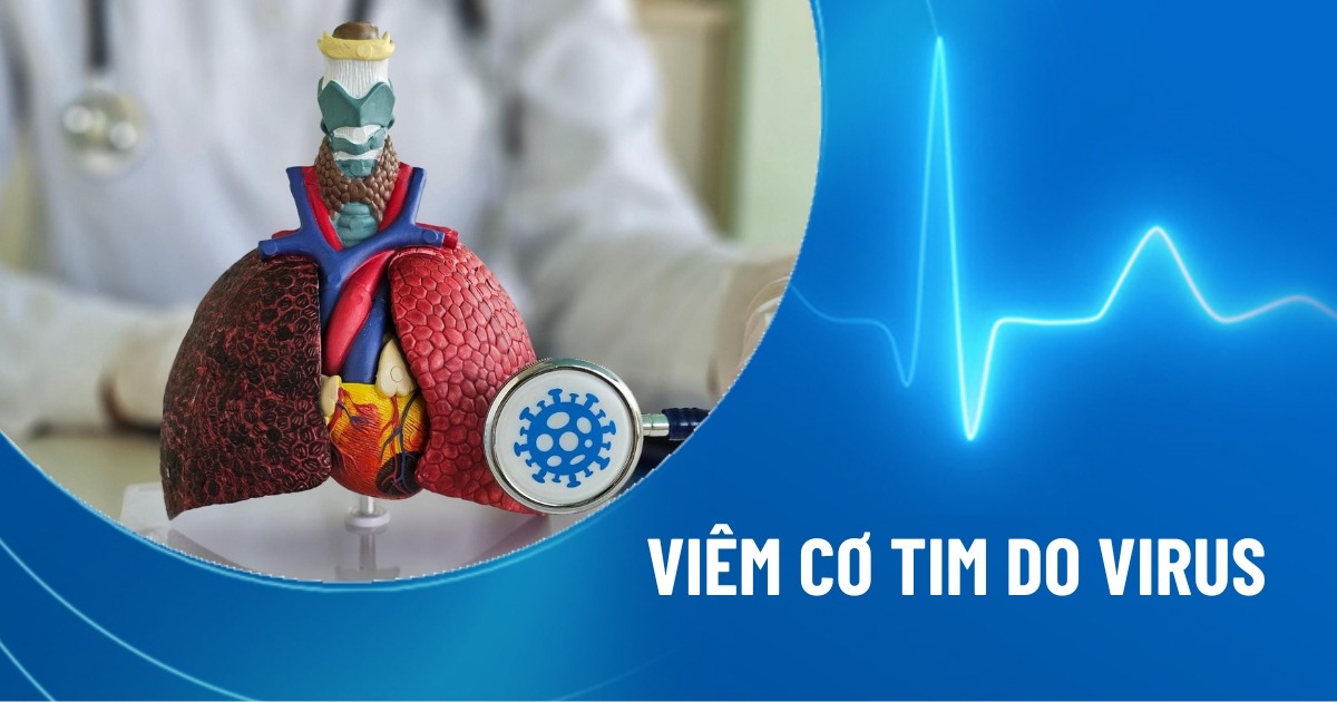 viêm cơ tim do virus