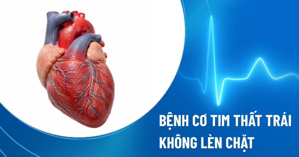 bệnh cơ tim thất trái không lèn chặt