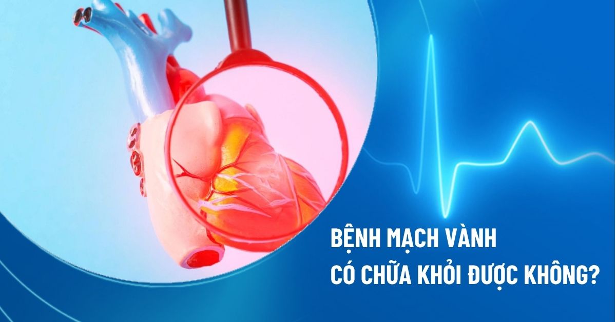 bệnh mạch vành có chữa khỏi được không