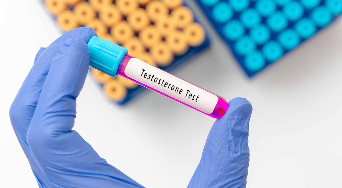 cần xét nghiệm testosterone 2 lần vào buổi sáng