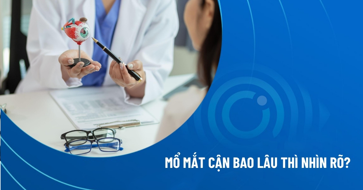 mổ mắt cận bao lâu thì nhìn rõ