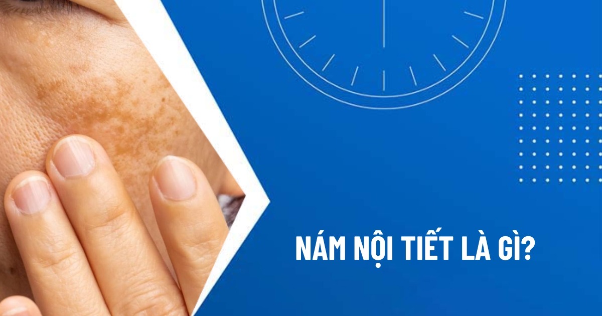 nám nội tiết
