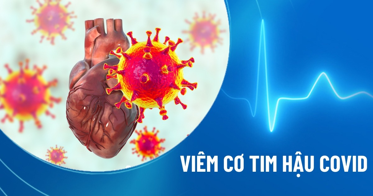viêm cơ tim hậu covid