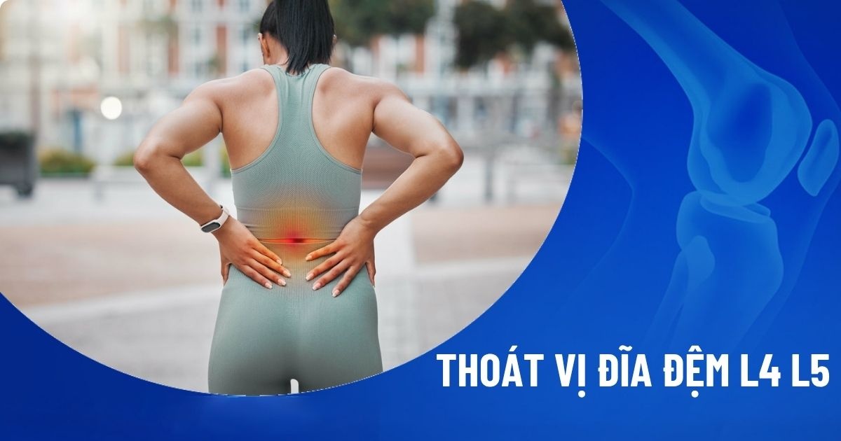 Thoát vị đĩa đệm L4 L5​