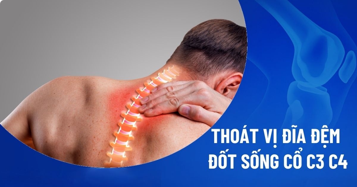 Thoát vị đĩa đệm đốt sống cổ C3-C4