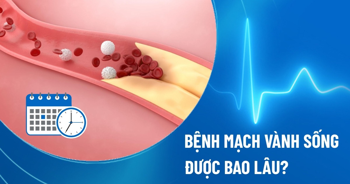 bệnh mạch vành sống được bao lâu