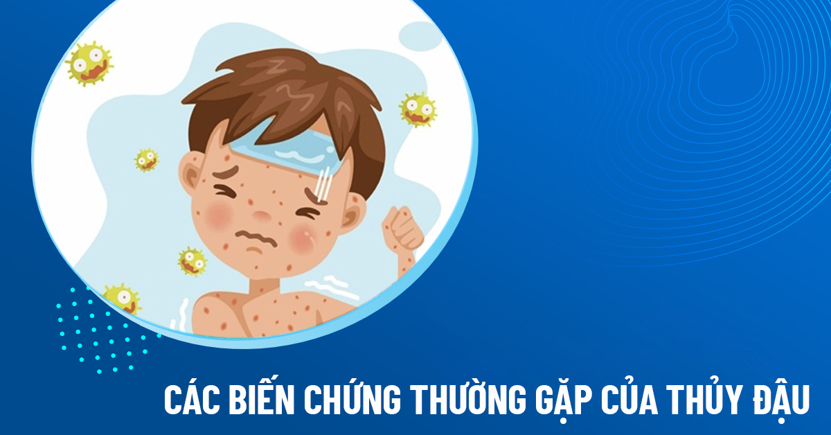 biến chứng thủy đậu
