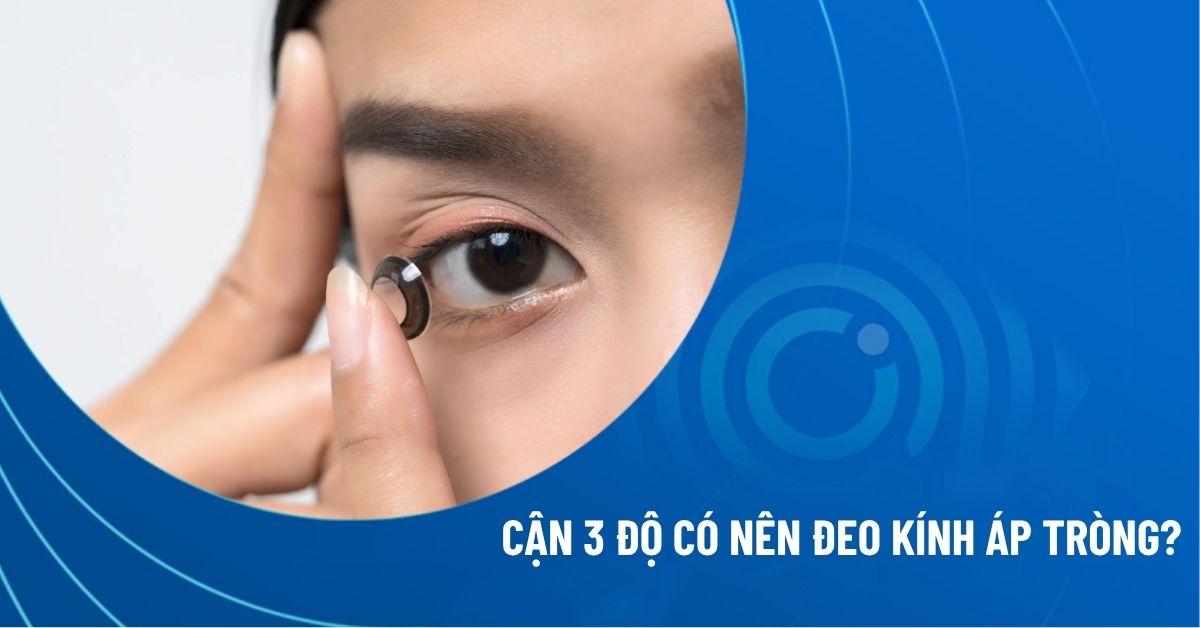 cận 3 độ có nên đeo kính áp tròng_