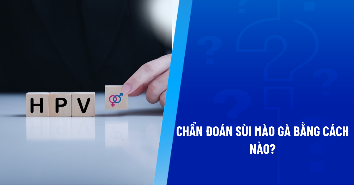 chẩn đoán sùi mào gà