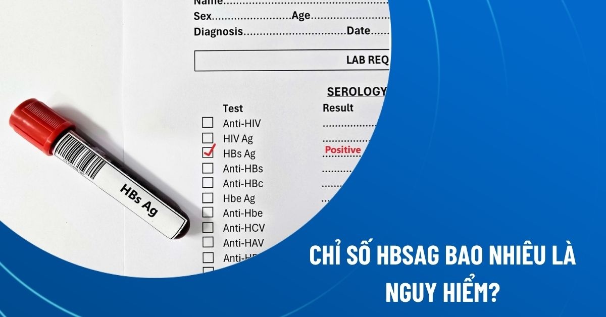 chỉ số HBsAg bao nhiêu là nguy hiểm