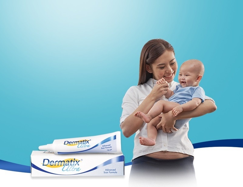 dermatix cho mẹ bầu
