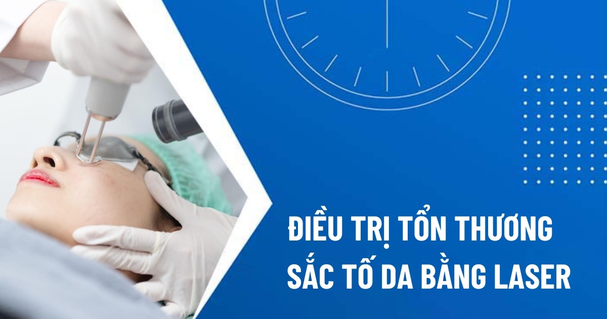 điều trị sắc tố da bằng laser