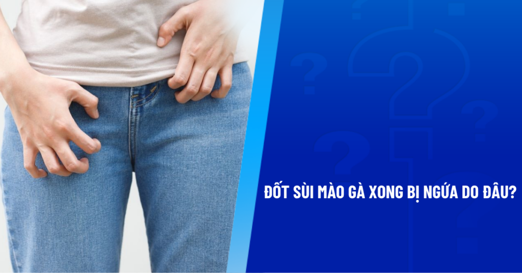 đốt sùi mào gà xong bị ngứa