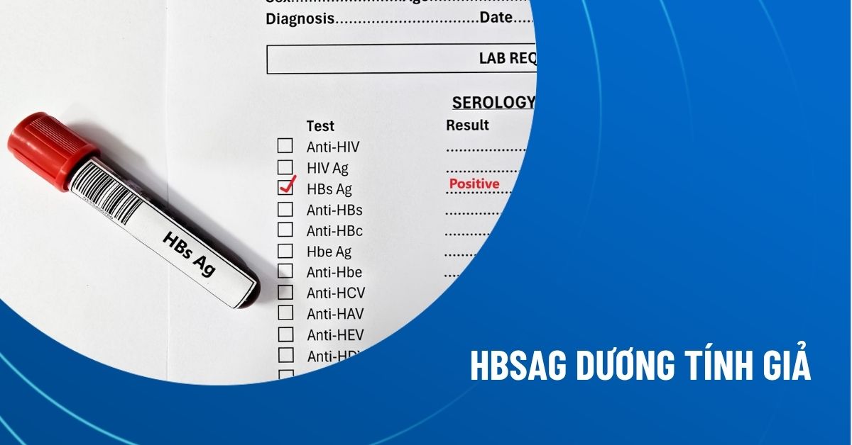 HBsAg dương tính giả​