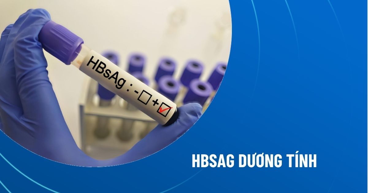 HBsAg dương tính