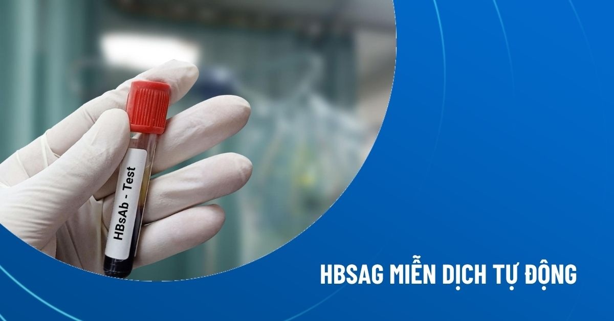 HBsAg miễn dịch tự động