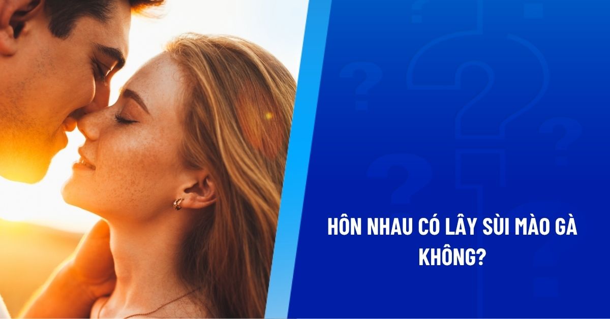 hôn nhau có lây sùi mào gà không