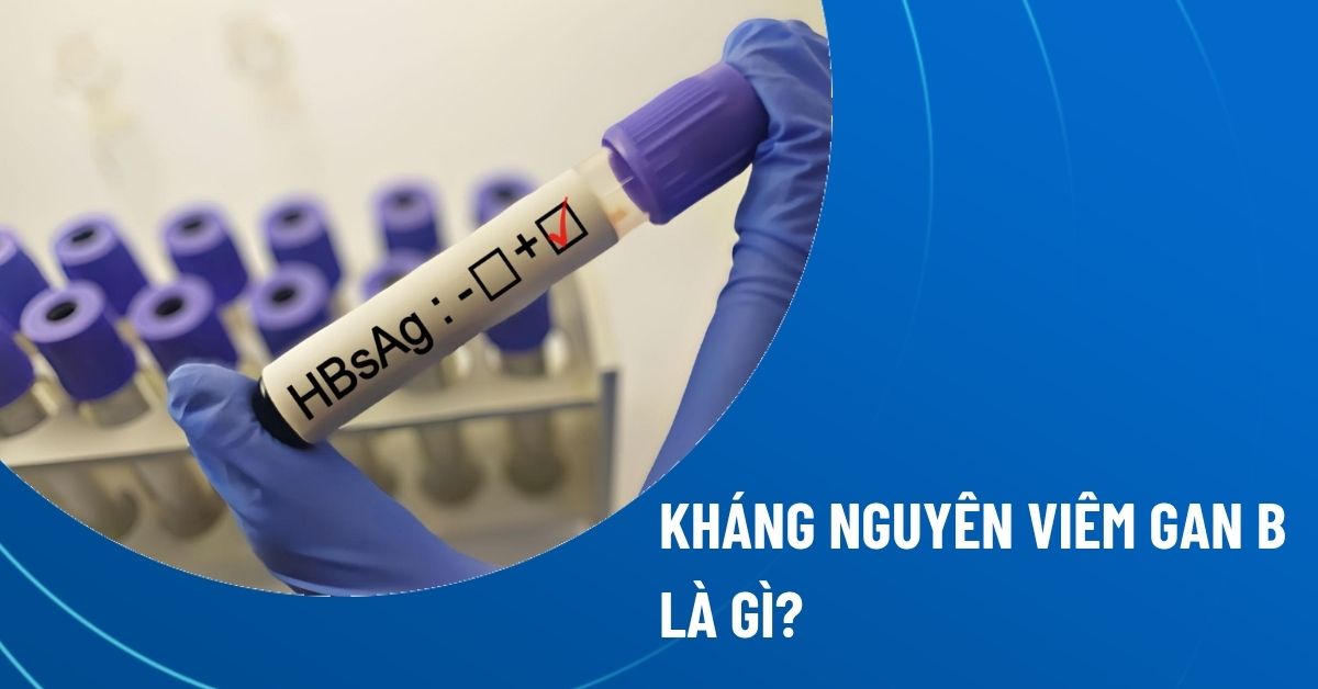 kháng nguyên viêm gan b