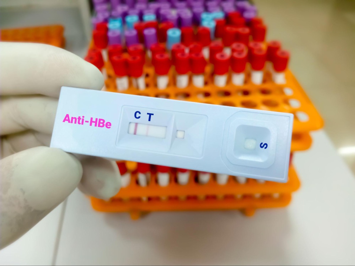 kháng thể anti-hbe