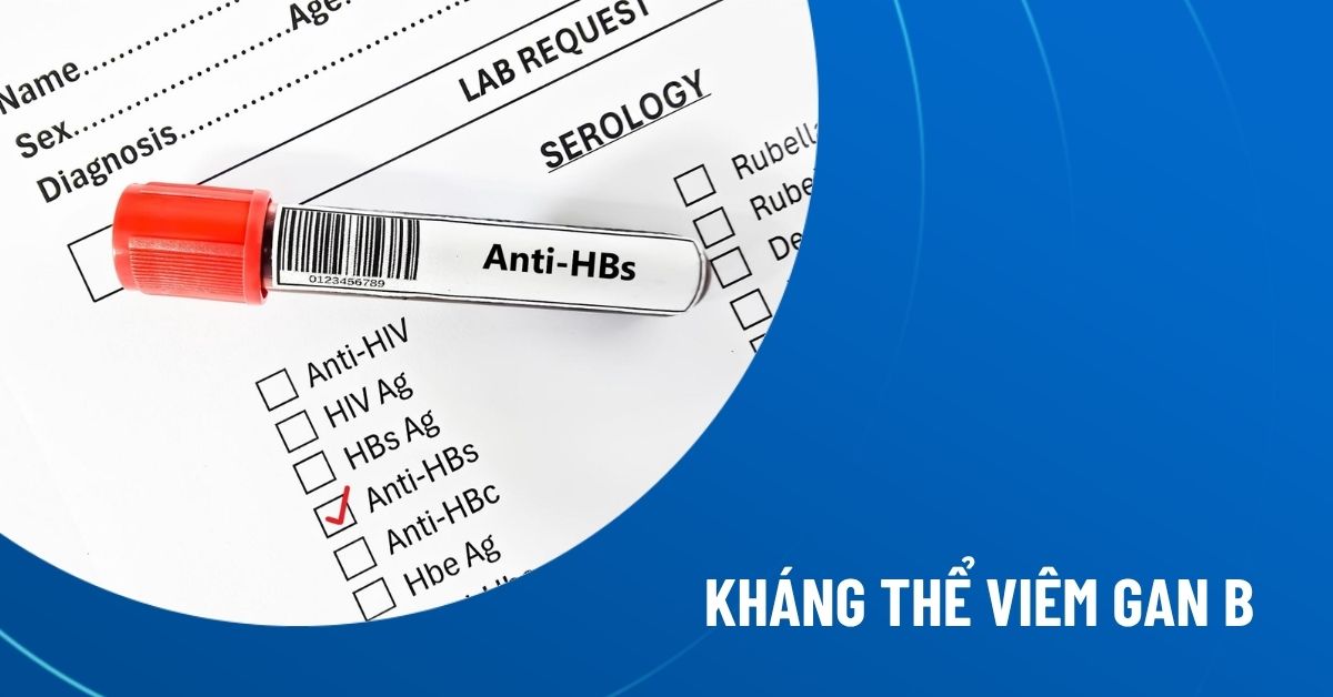 kháng thể viêm gan b