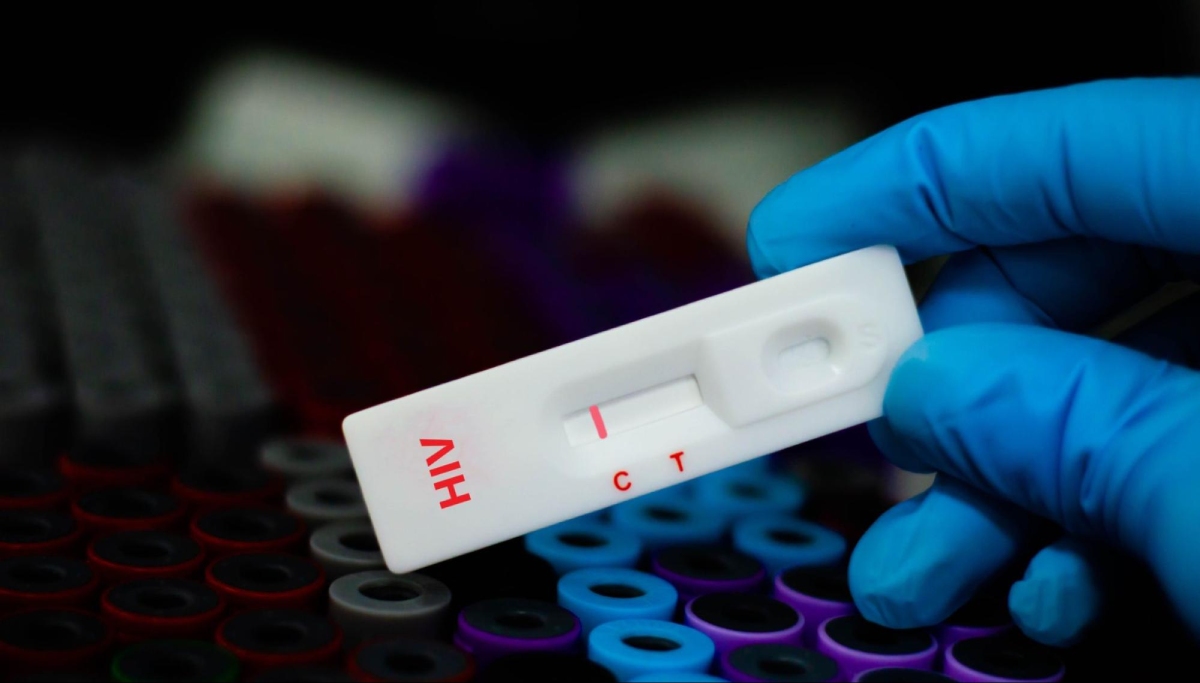 kit test xét nghiệm hiv