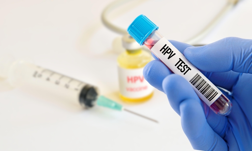 ống nghiệm hpv test