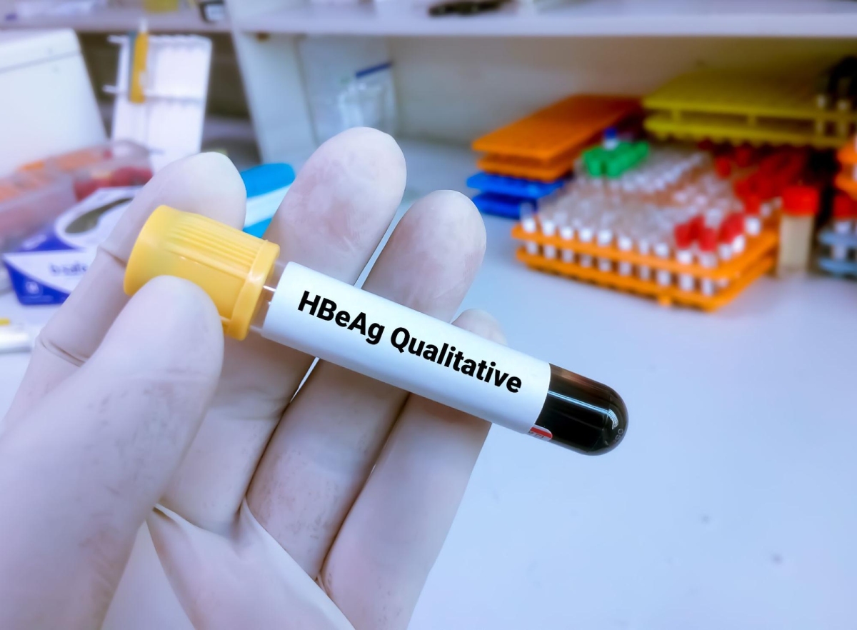 ống xét nghiệm HBeAg