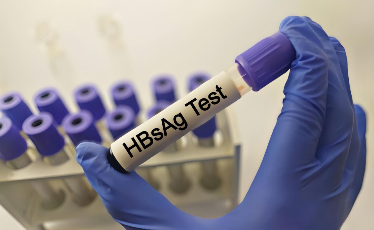 ống xét nghiệm hbsag