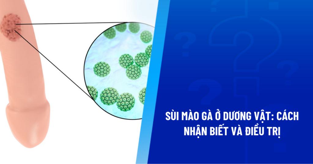 sùi mào gà ở dương vật