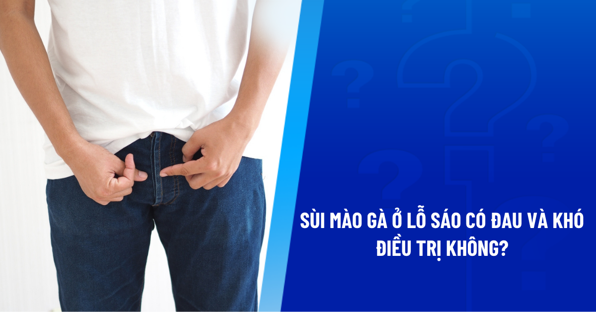 sùi mào gà ở lỗ sáo