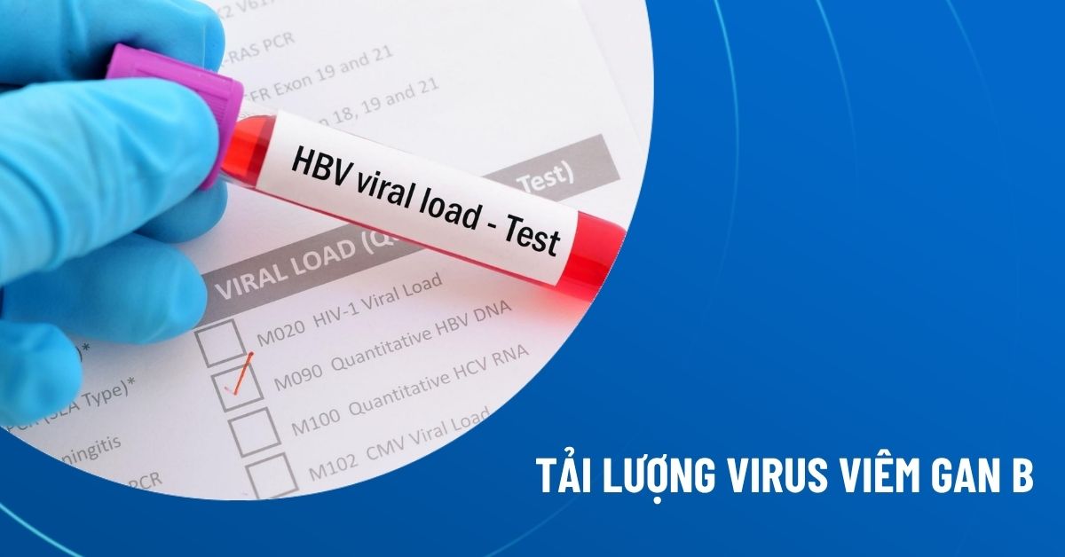 tải lượng virus viêm gan b