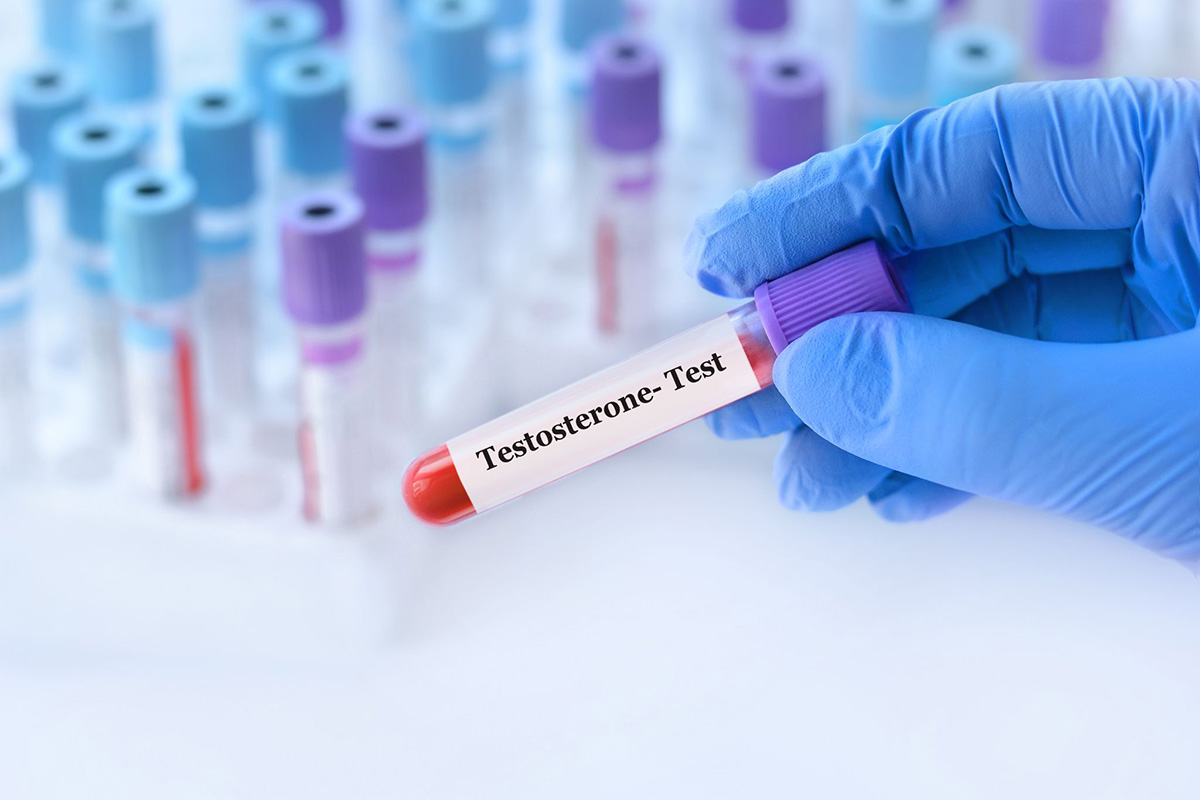 testosterone là hormone sinh dục chính của nam giới