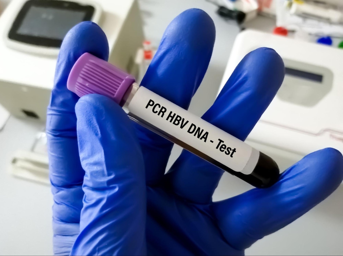 test chỉ số hbv dna