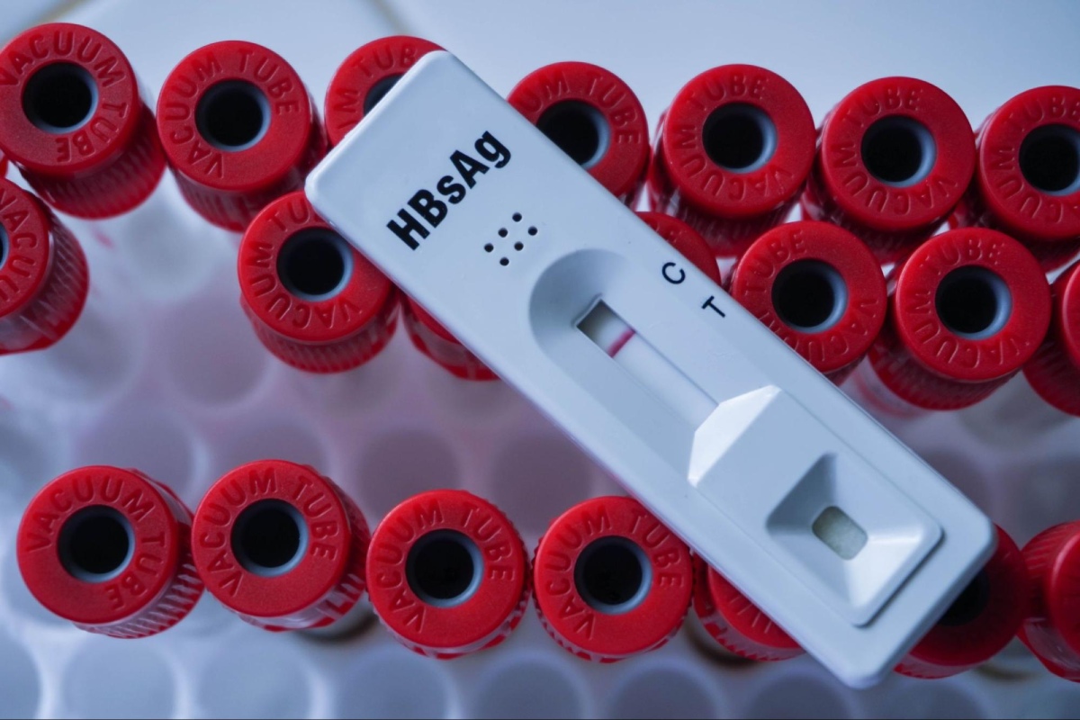 test hbsag tự động