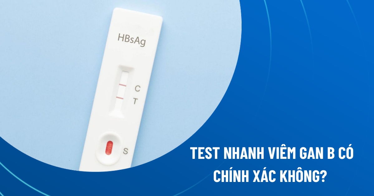 test nhanh viêm gan B