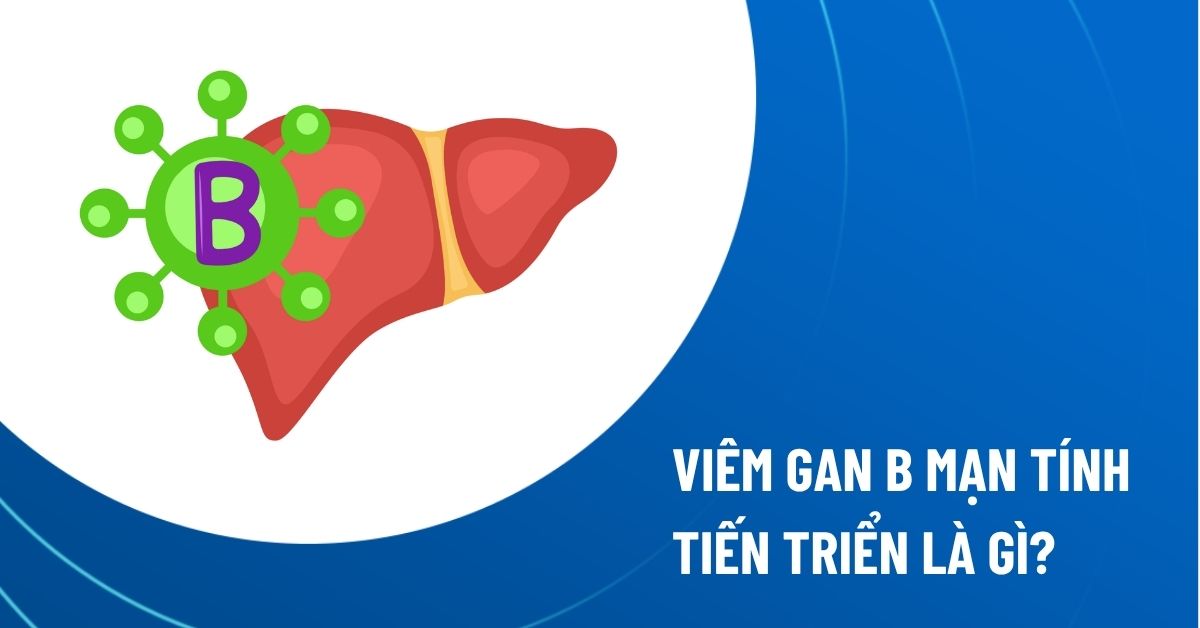 viêm gan b mạn tính tiến triển
