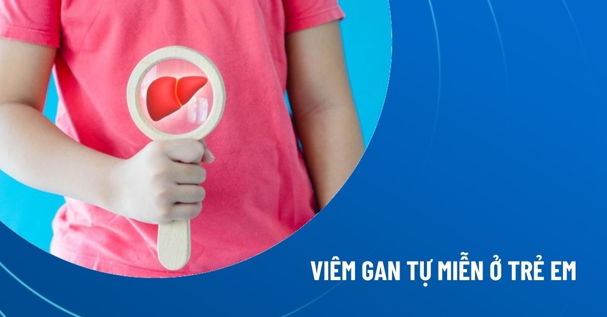 viêm gan tự miễn ở trẻ em