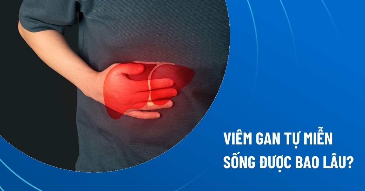 viêm gan tự miễn sống được bao lâu