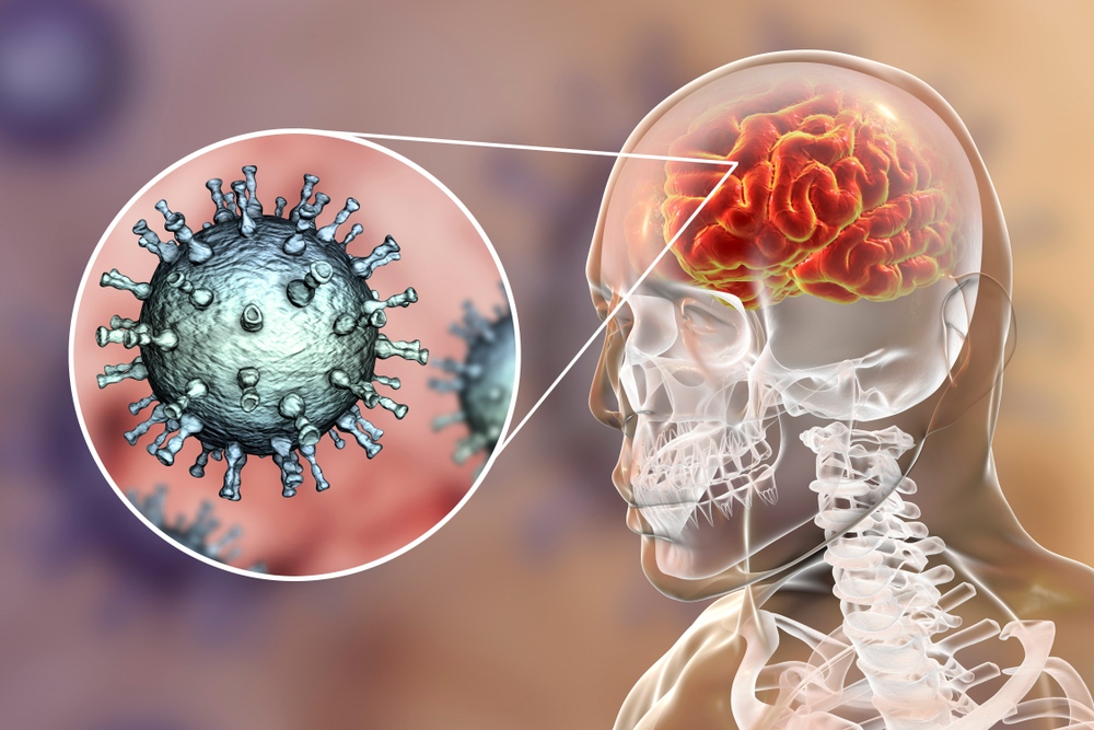 virus xâm nhập hệ thần kinh