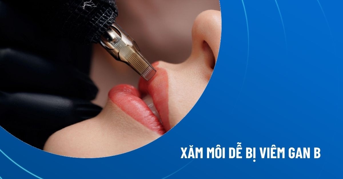 xăm môi dễ bị viêm gan B