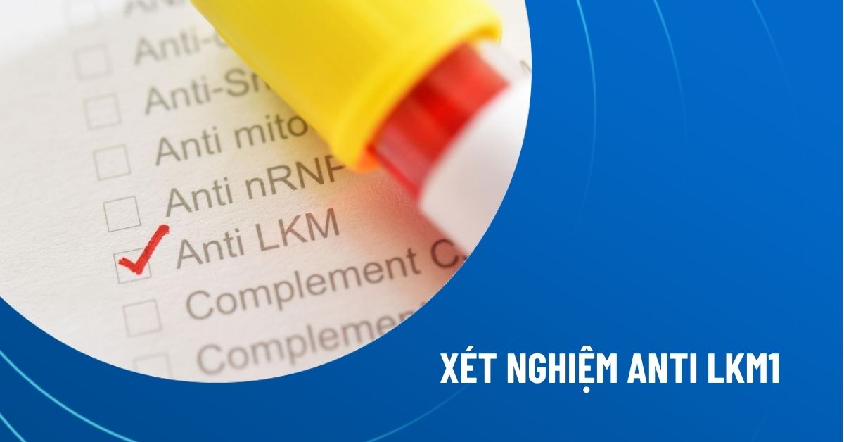 xét nghiệm Anti-LKM-1