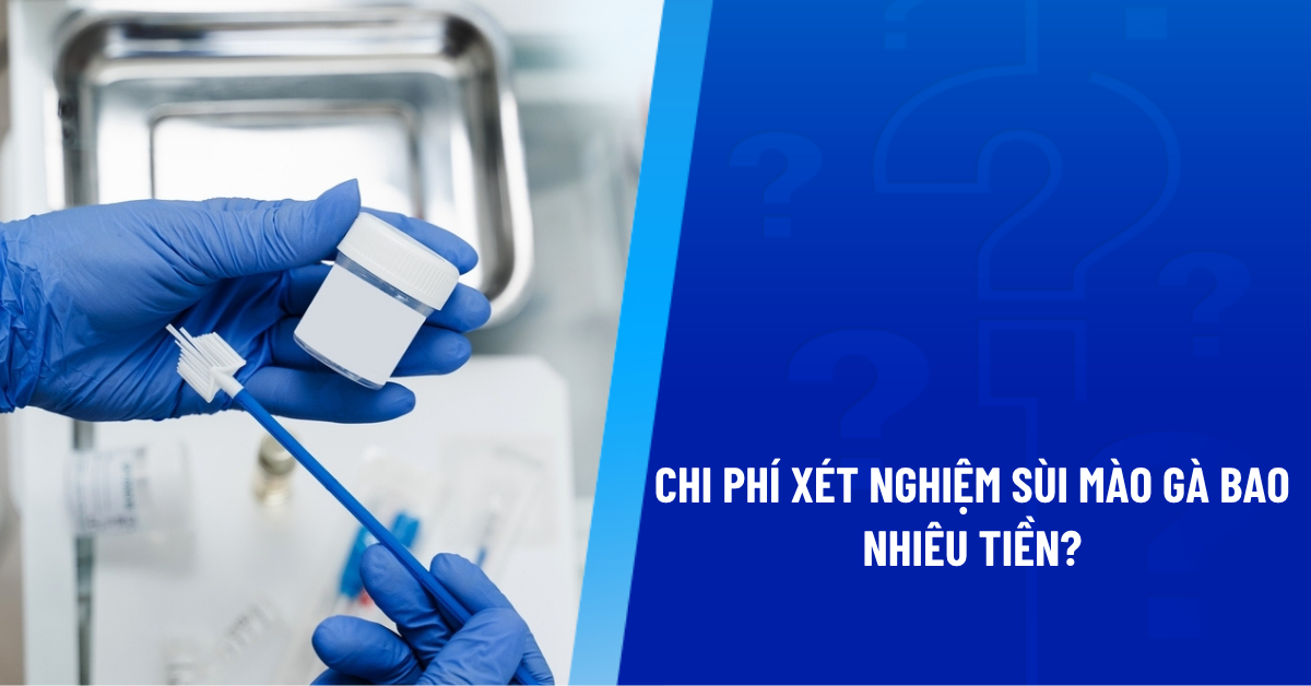 xét nghiệm sùi mào gà bao nhiêu tiền