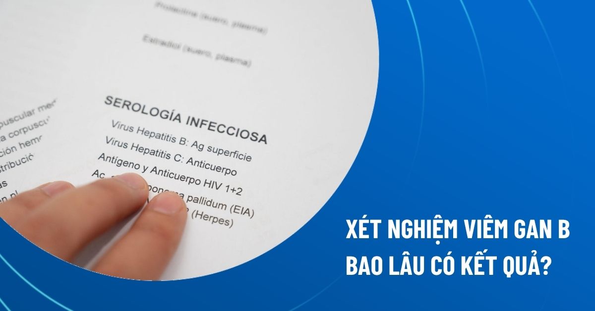 xét nghiệm viêm gan b bao lâu có kết quả