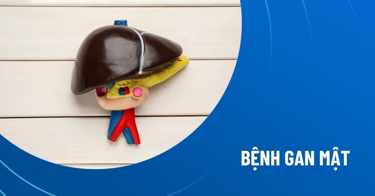 bệnh gan mật