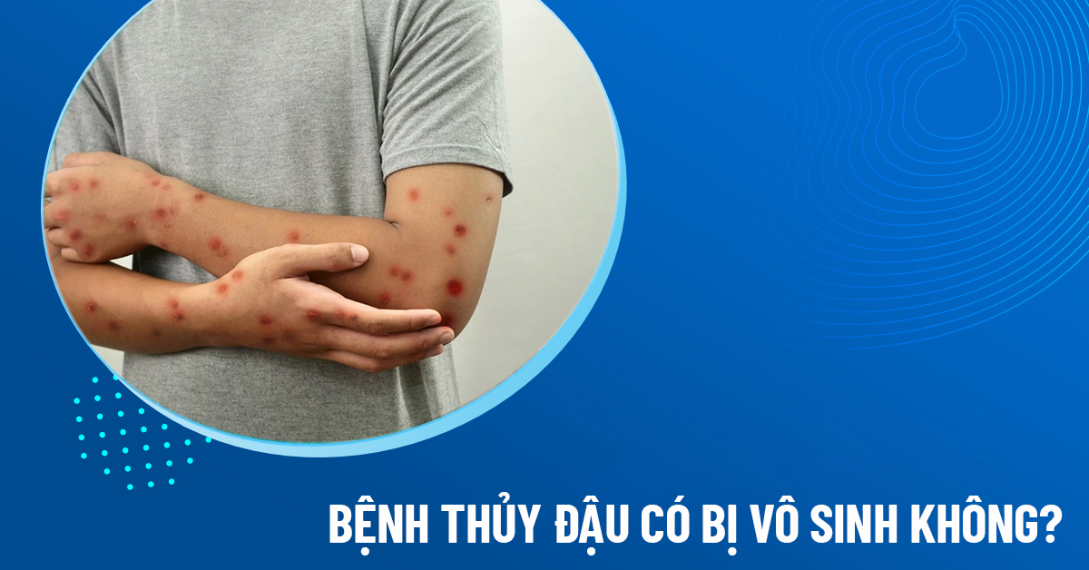 bệnh thủy đậu có bị vô sinh không