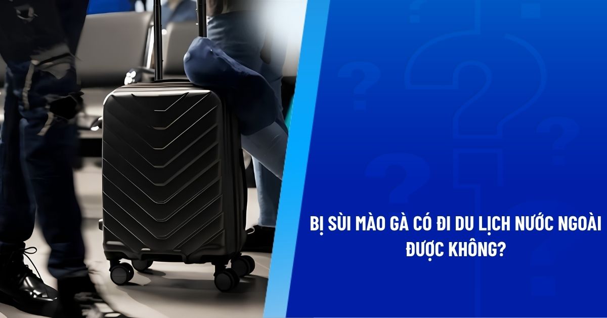 bị sùi mào gà có đi du lịch nước ngoài được không