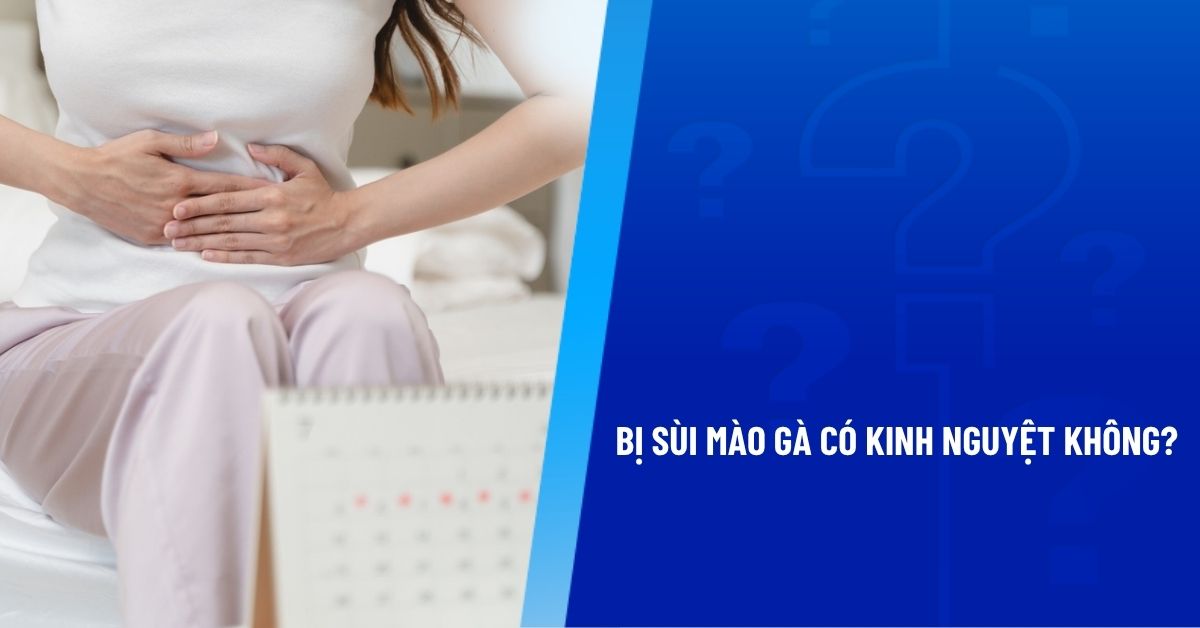 bị sùi mào gà có kinh nguyệt không